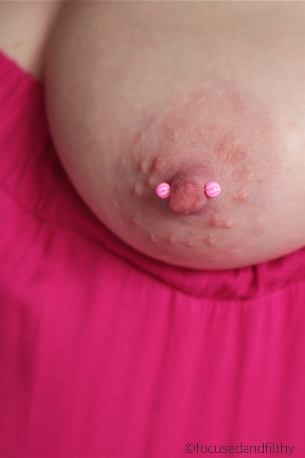 Colour close up photograph of a left breast and nipple which has a pink cAn...